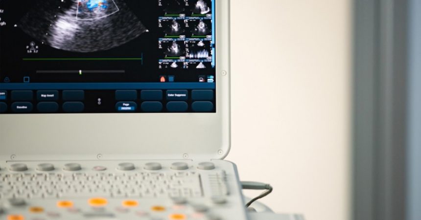 A Portable Ultrasound Machine for Sale Is Worth Thinking About