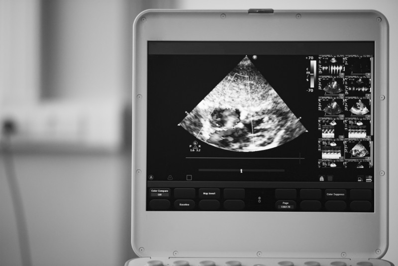 Factors to Consider Before Buying an Ultrasound Machine in North Charleston